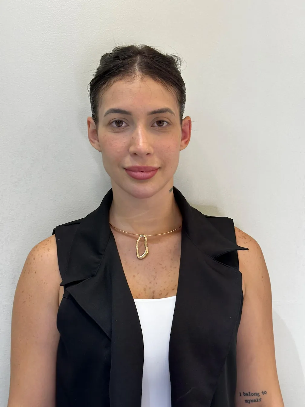 Antes da correção de orelhas de abano - Paciente em busca de autoestima e confiança com otomodelação